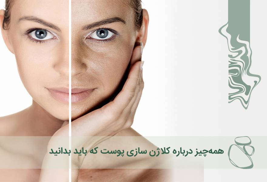 همه‌چیز درباره کلاژن سازی پوست که باید بدانید
